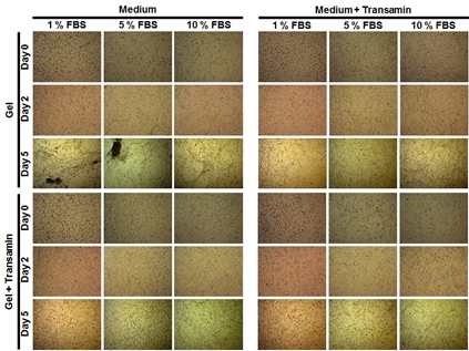 그림 10. Transamin과 Serum 농도에 따른 세포시트형 세포이식체 제조 유도용 하이드로젤의 fibrinolysis