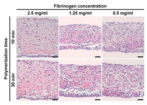 그림 11. Fibrinogen의 농도에 따른 세포시트형 세포이식제 유도 피브린 하이드로젤의 용해도 및 세포간 결합