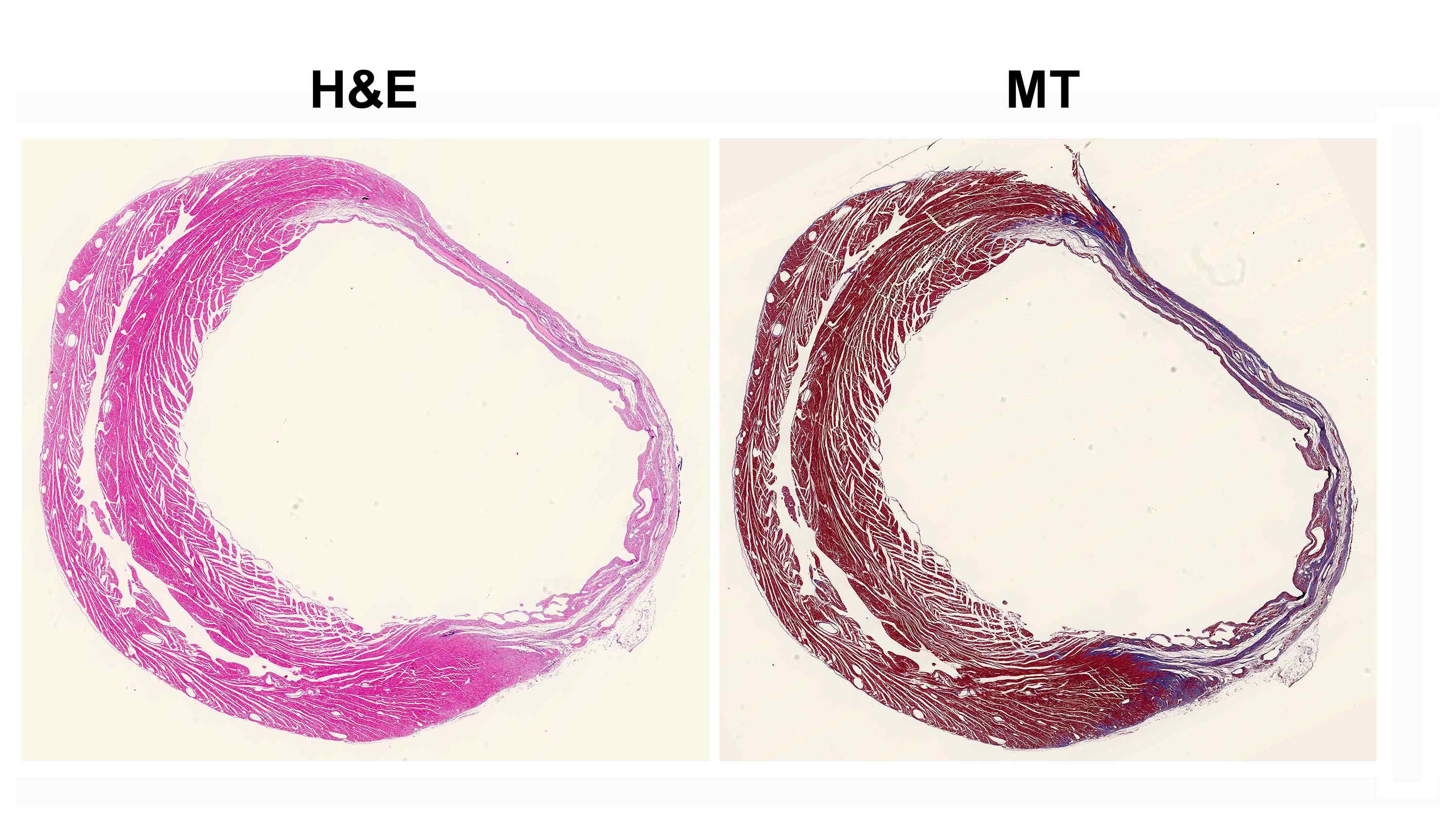 그림 13. 랫트의 심근경색 유도 후 심장 조직의 Hematoxylin and Eosin 염색과 Masson's trichrome 염색