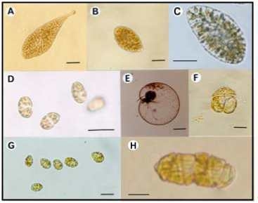 일본에서 적조를 유발하는 유해 플랑크톤 A) Chattonella antique B) C. marina （C）, C. ovata（D）, Heterosigma akashiwo（E）Noctiluca scintillans (F) Heterocapsa circularisquama (G) Cochlodinium polykrikoides. (Imai 2008)