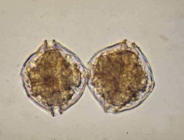 마비성 패독을 일으키는 원인종 중 하나인 Alexandrium tamarense의 광학현미경 사진 (photo by WHOI / D. Anderson)
