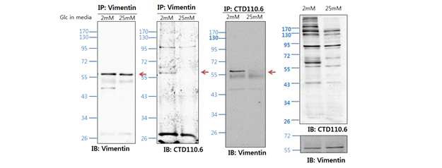 [ 그림 5. 저당 조건에서 vimentin의 O-GlcNAc 수식화 변화 확인 ]