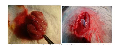그림 1. 2m Enterotomy 시행후 봉합을 시행한 모습(좌)과 폐복 전 Drain을 거치한 모습 (우)