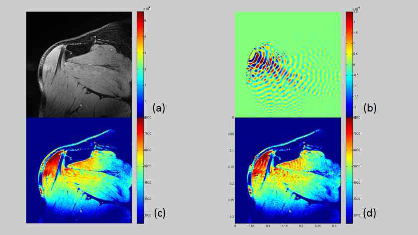 그림8.Direct Inversion 기법으로 복원된 인체의 Stiffness. MRI 어깨 영상