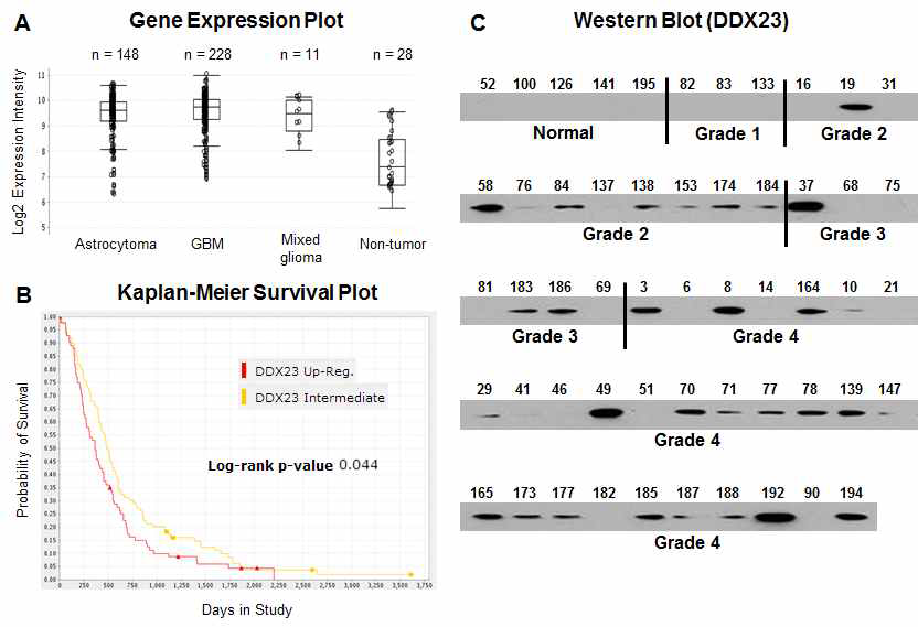 그림 14. 악성뇌신경교종환자의 암조직과 정상조직에서의 DDX23의 발현 및 생존예후 분석