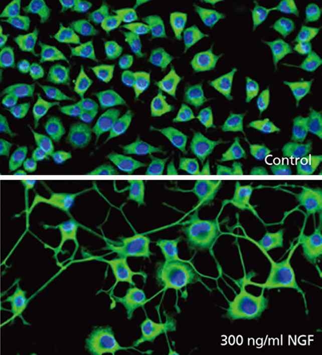 NGF처리 전후의 NS-1 세포