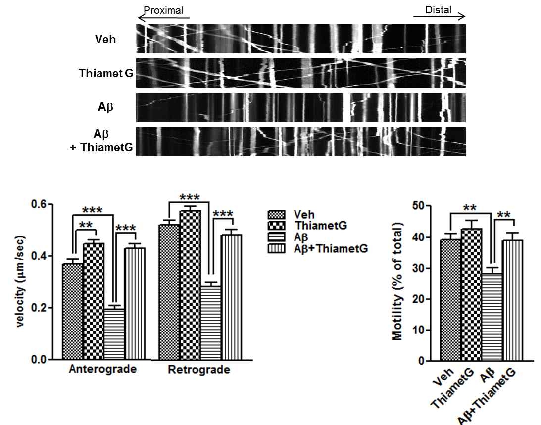 Aβ와 Thiamet G를 동시에 처리한 후 미토콘드리아의 axonal transport의 변화를 실시간으로 촬영한 후 분석