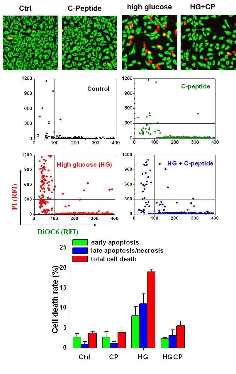 High-glucose (HG)에 의해 유도된 세포 사멸 및 C-peptide (CP) 처리 시 세포사멸 억제