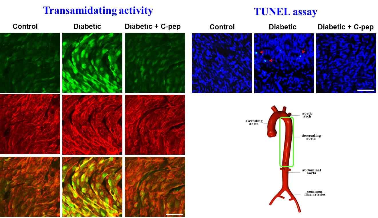 당뇨병을 유도시킨 마우스의 대동맥에서의 TG 활성도 (transamidating activity)와 세포사멸 (TUNEL assay) 확인 결과