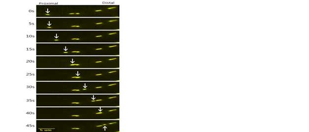 Mito-dsRed를 transfection하여 mitochondria의 axonal transport를 실시간으로 관찰