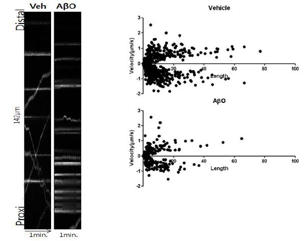 Abeta 처리시 kymograph (좌측)을 이용하여 mitochondria의 이동속도 관찰 후 이동속도 및 이동 거리 분석