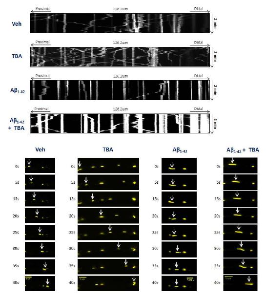 Abeta와 TBA를 동시에 처리한 후 미토콘드리아의 axonal transport의 변화를 실시간으로 촬영한 후 분석