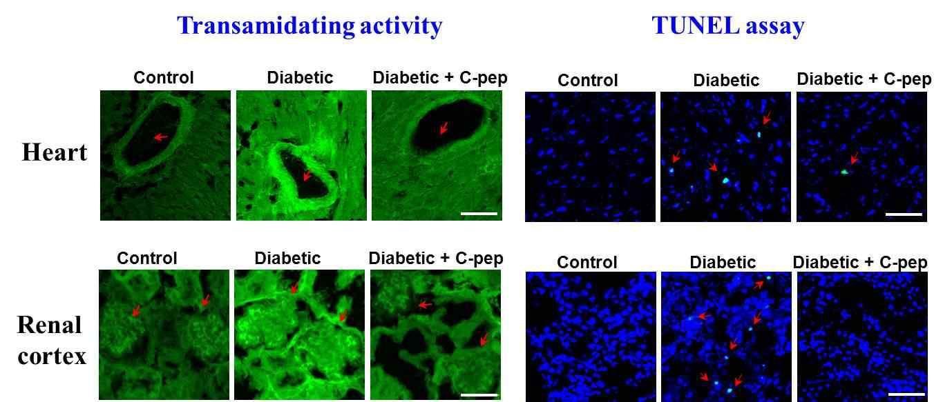 당뇨병을 유도시킨 마우스의 심장과 신장에서의 TG 활성도(transamidating activity)및 세포사멸 (TUNEL assay) 확인 결과