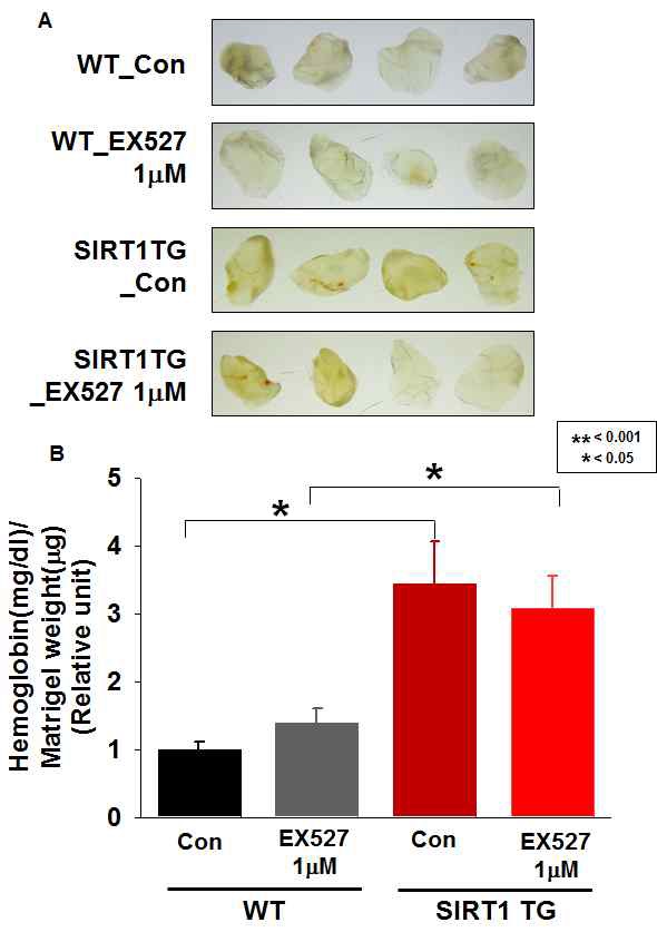 Fig. III-4 The role of SirT1 in tumor angiogenesis