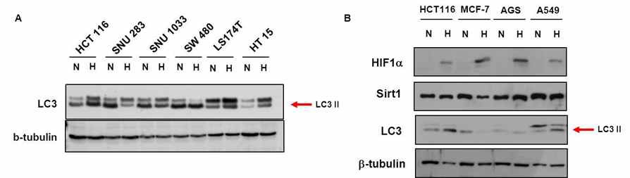 Fig. IV-2 (A) 대장암세포주 24 시간동안 저산소 상황에 나둔 후 LC3Ⅱ 발현 비교. (B) 4종의 암세포주를 저산소에 24시간 나둔 후 SirT1의 발현양 확인.
