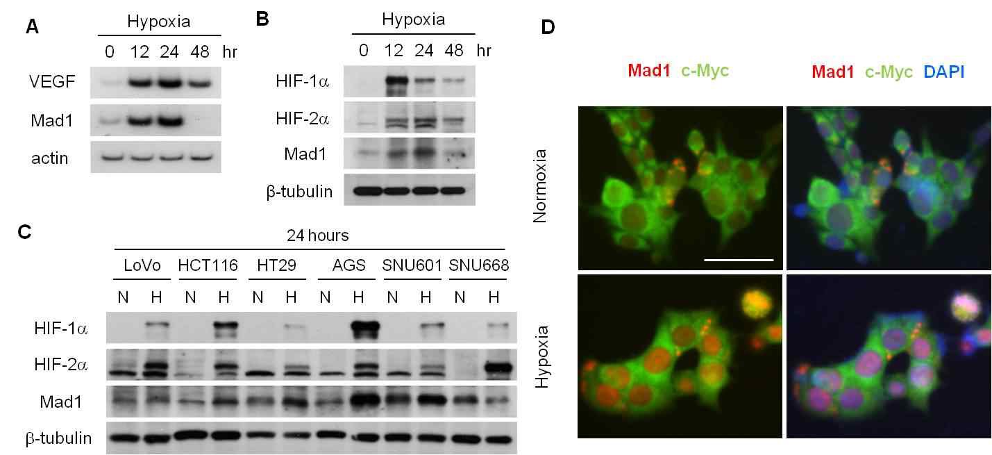 Fig. VIII-1. Hypoxic induction of Mad1 in colon and stomach cancer cells