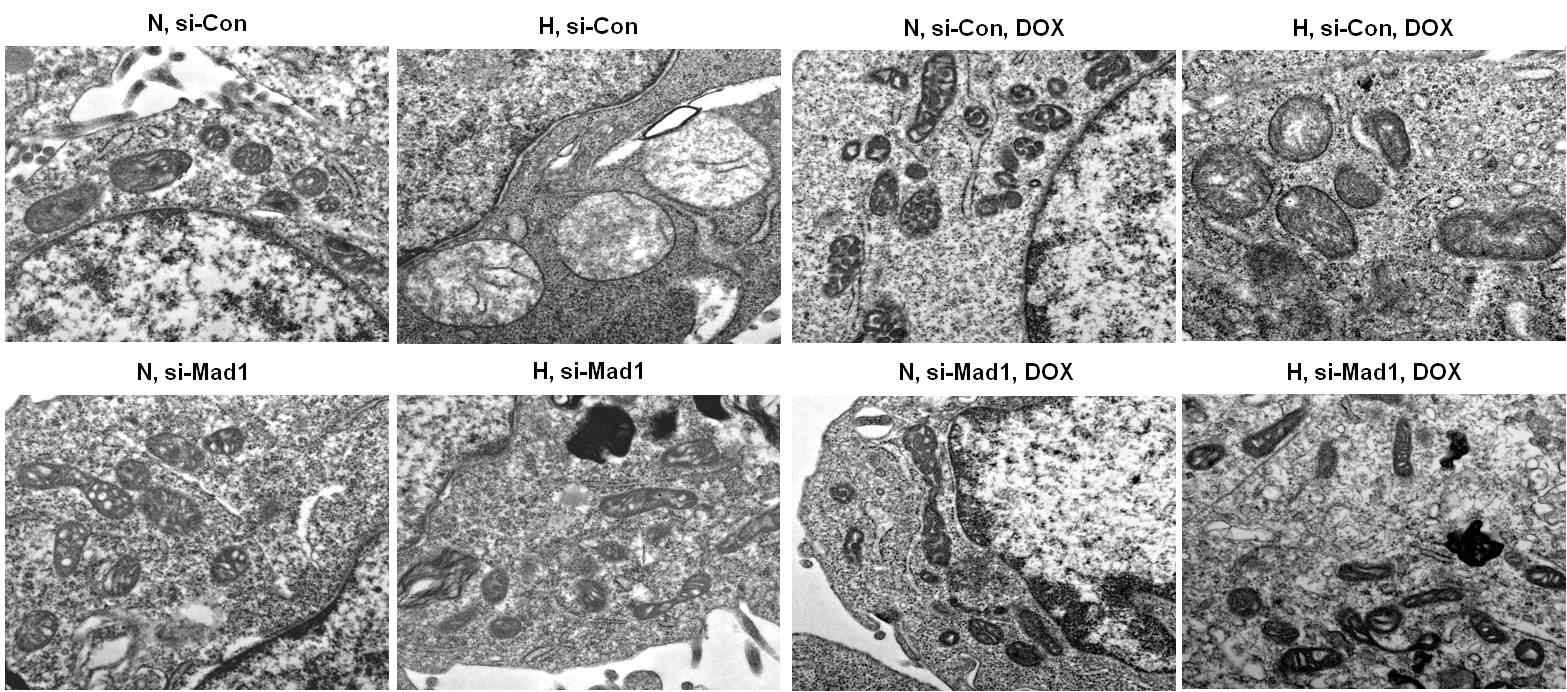 Fig. VIII-6. Mad1 contributes to the formation of enlarged mitochondria under hypoxia. HCT116 cells were transfected with 40 nM of control or Mad1 siRNAs, and incubated under normoxia or hypoxia for 48 hours. Electron micrographs (x 25,000) of HCT116 cells from each condition were acquired. DOX, doxorubicin