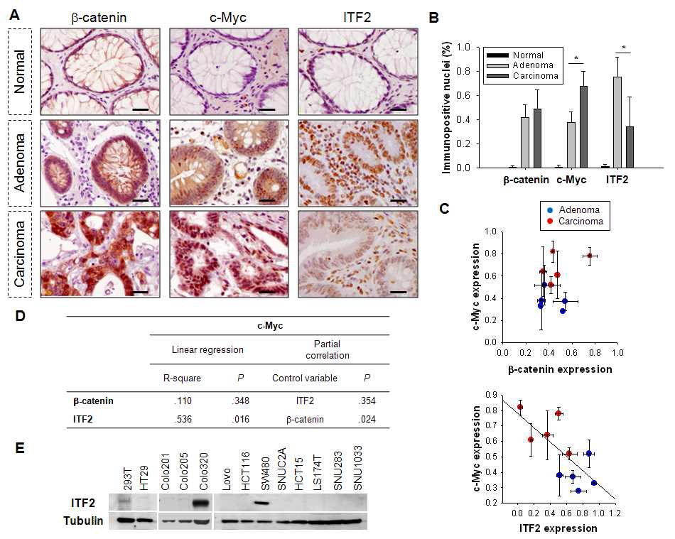 Figure IX-1. Enhanced b-CTN/TCF4 transcriptional activation and reciprocally down-regulated ITF-2 expression in colon carcinoma