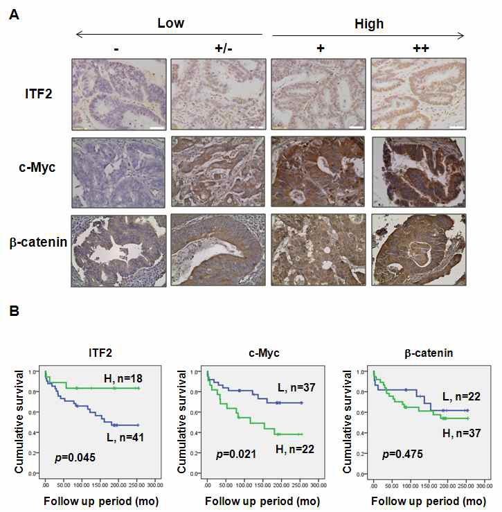 Figure IX-6. ITF2 suppression associates with poor survival in human colon cancer patients
