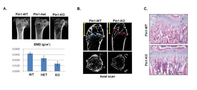 (Figure 5. Pin1-/- 성체마우스의 골밀도 및 조직학적 골염색)