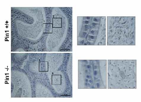 (Figure 12. 정소에서 Runx2 발현 조사)