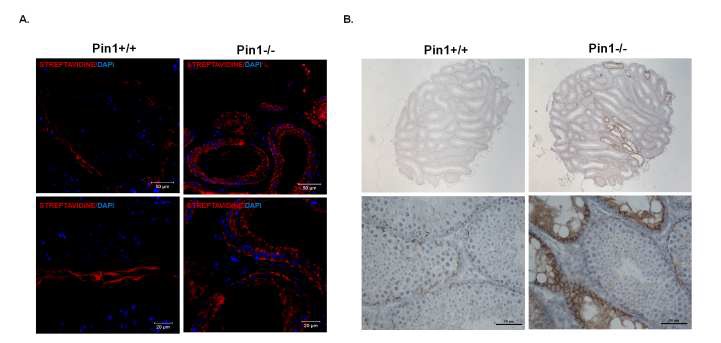 (Figure 14. Pin1-/-에서 blood-testis barrier (BTB)의 비정상적 발달)