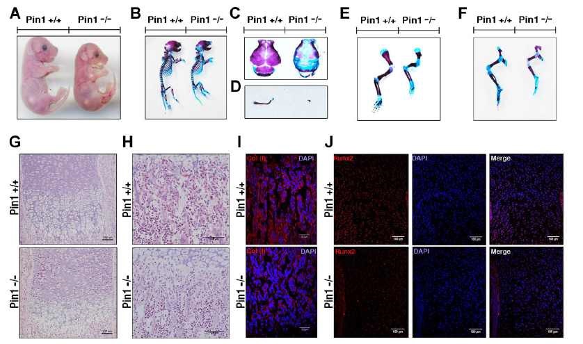 (Figure 1. Pin1 유전자 적중 마우스의 골 형성능 저하)