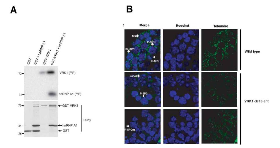 (A) VRK1과 hnRNP A1의 인산화 반응 실험 (B) VRK1 유전자 결손 쥐 모델에의 in situ hybridization 실험