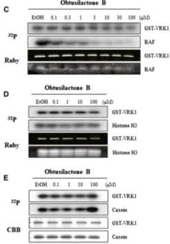 (C) Obtusilactone B에 의한 BAF의 인산화 저해도 측정 (D) Obtusilactone B 에 의한 H3의 인산화 저해도 측정 (E) Obtusilactone B에 의한 Casein의 인산화 저해도 측정