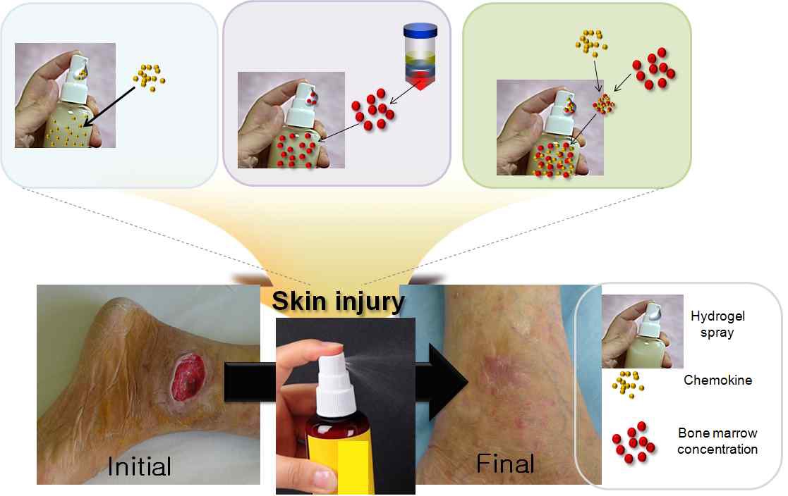 그림. 분사형 손상피부 치료제 개발 전략도