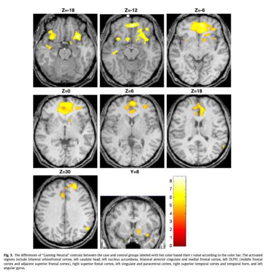 The associations between aggressive behaviors and internet addiction and online activities in adolescents