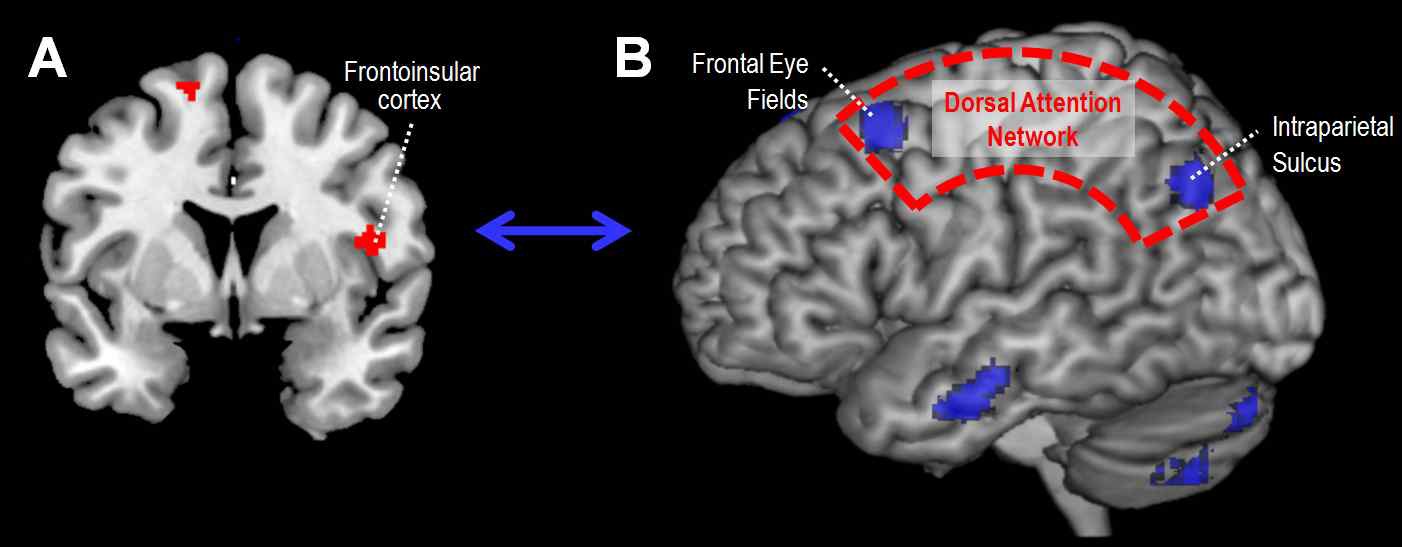 정서간섭이 있는 주의집중력 과제를 수행하는 동안 insula(A)와 기능적 연결성(functional connectivity)을 보인 뇌 영역들(B)