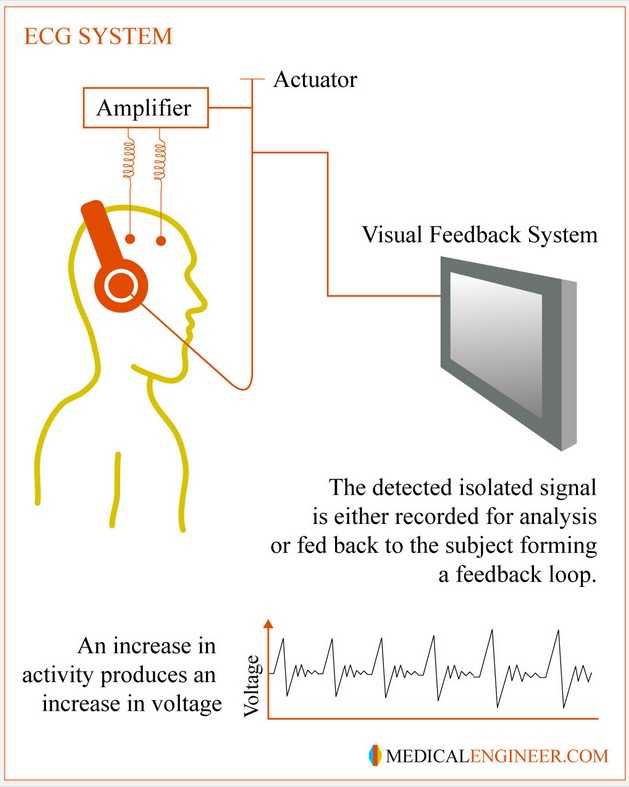 http://heartzine.com/biomedical/eeg_applications_in_modern_medicine.html