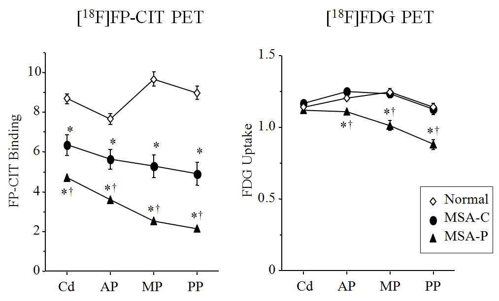 Fig 1. Repeated measures ANOVA showed significant differences between regions (p<.0001) and diagnosis (p<.0001) with significant interactions between the two variables (p<.0001) for [18F]FP-CIT binding and [18F]FDG uptake in the striatum. Contrary to [18F]FP-CIT binding, [18F]FDG uptake showed differences only in the putamen of the MSA-P.Cd: caudate, AP: anterior putamen, MP: middle putamen, PP: posterior putamen