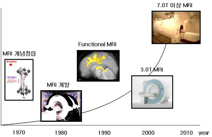 그림 1. MRI 발전동향