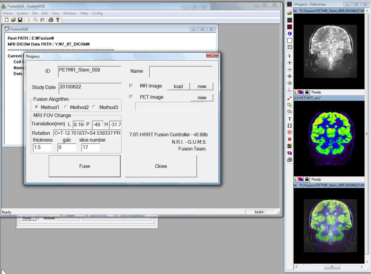 그림 12. 개발된 MRI-PET 복합시스템 전용 소프트웨어