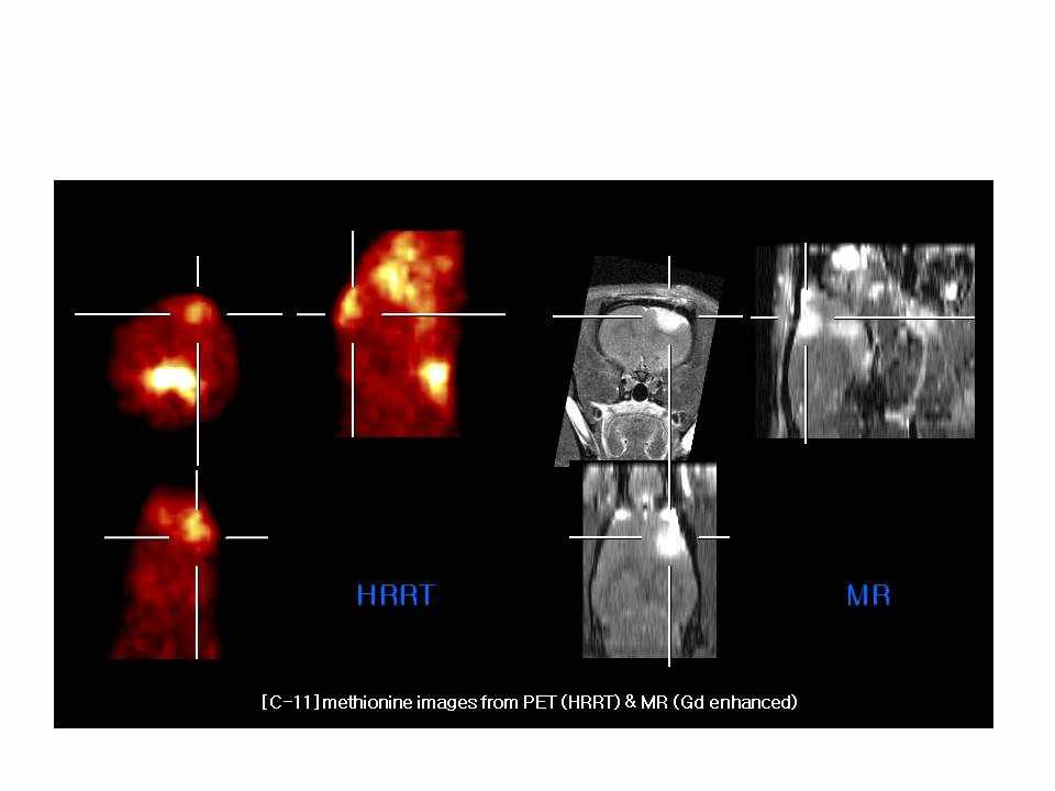 그림 52. 뇌종양 모델 마우스에서의 [11C]methionine의 섭취영상; PET(좌), MR(우).