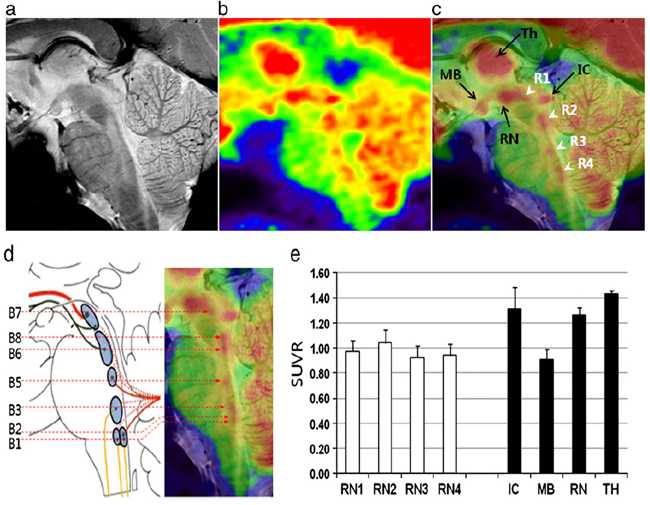 그림 54. a. 뇌간의 7.0T MRI 영상 b. 포도당 대사 영상 c. MRI-PET 복합영상 d. 뇌간의 해부학적 구조와 복합영상 e. 뇌간의 세부 영역 및 주변부의 포도당 대사량