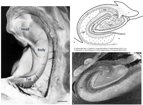 그림 79. 해마의 구조. 긴 축을 따라 머리, 몸통, 꼬리로 구분하며 단면도에서 CA1, CA2, CA3, CA4 로 구분 한다.