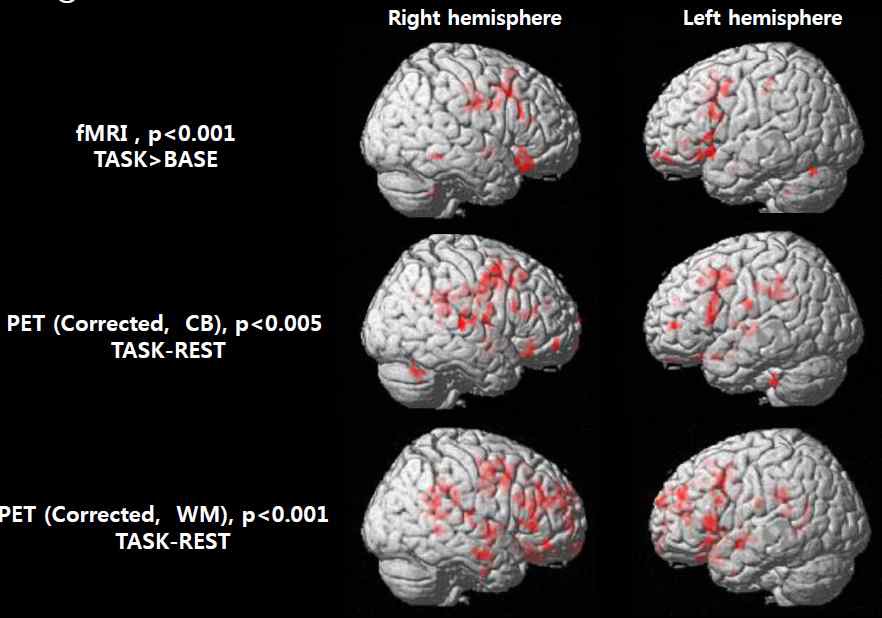 그림 104. motor 자극에 대한 fMRI 및 PET 영상 결과 비교