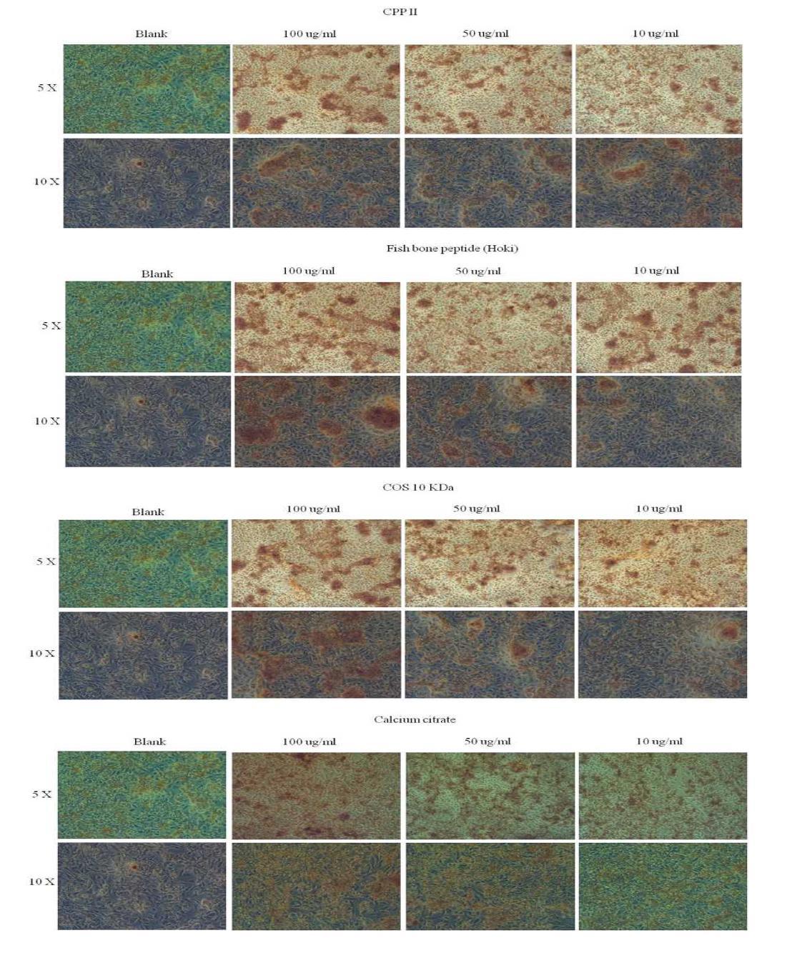 Osteoblastic cell (MG-63)에서의 키토산 올리고당 (COS, 10 kDa), CPP-II, fishi bone peptide (Hoki) 및 Cacium citrate의 처리농도별 미네랄 형성 활성 (a) 미네랄 생성활성 비교 data (b) Alizarin-red 염색 이미지