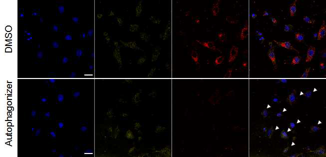 그림 10. SYNJ2-YFP 과발현 세포는 endocytosis에 영향을 주지 않지만, autophagonizer에 의해 더 강하게 endocytosis를 저해함