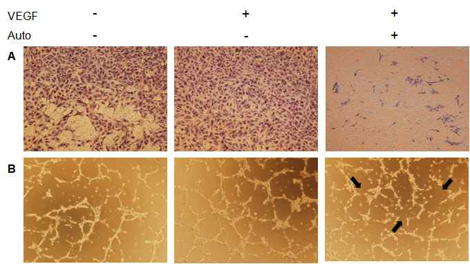 그림 14. VEGF에 의해 유도된 HUVEC의 혈관신생을 저해함
