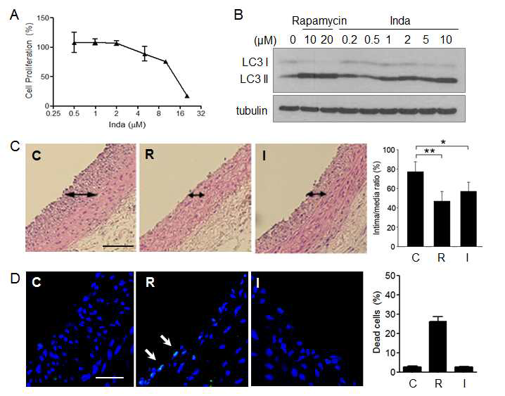 그림 24. (A) Inda는 SMC 성장을 저해함. (B) SMC에서 LC3 conversion을 유도함. (C) Rat restenosis model에서 SMC accumulation을 저해함. (D) Inda는 SMC에서 세포사멸을 일으키지 않음
