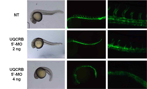 그림 27. UQCRB morpholino를 zebrafish에 injection 한 결과 혈관신생이 저해됨