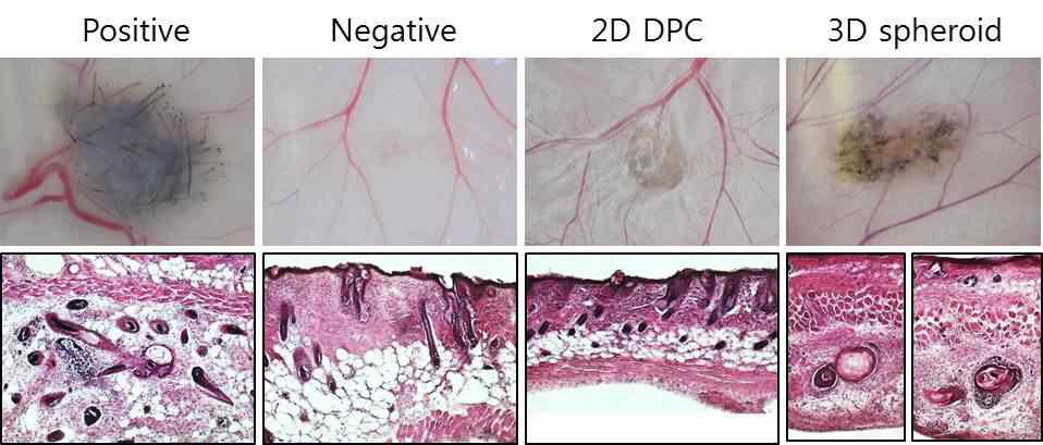 3D배양 모유두세포의 모낭형성능