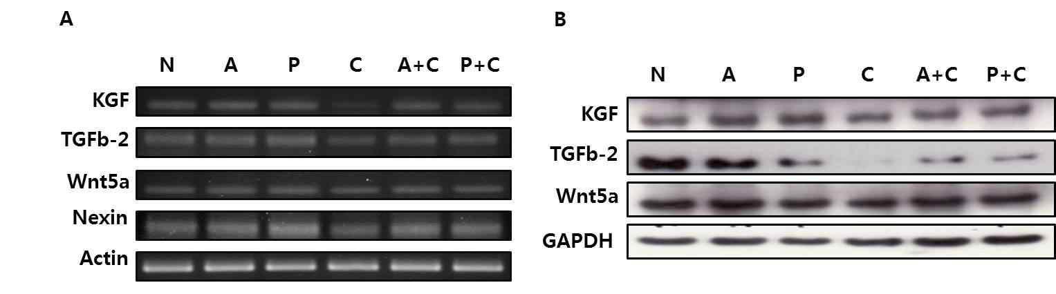 CRH수용체와 CRH신호경로를 통한 스트레스호르몬의 모유두세포 내 작용 (A:수용체 antagonist, P:PKA inhibitor, C:CRH)