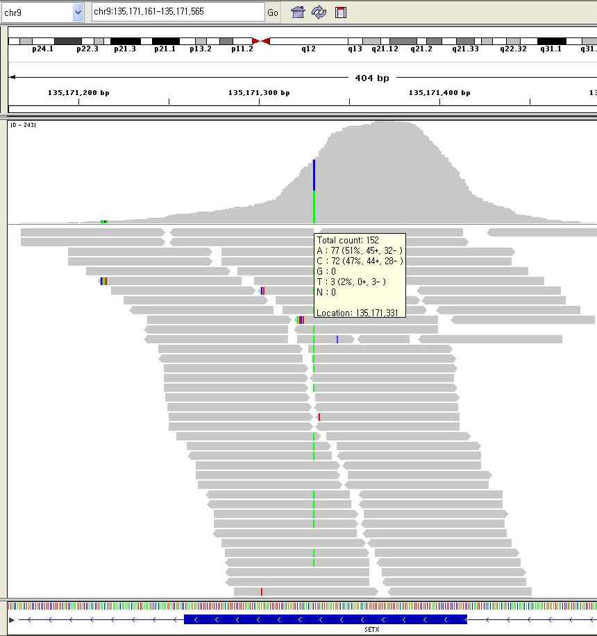 Figure 1. Exome sequencing 분석으로 발견된 SETX c.6034G>T (p.Ala2012Ser) 변이