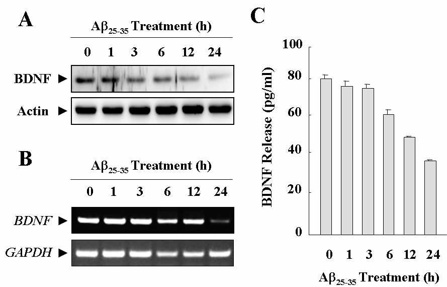 Fig. 1 Effect of Aβ25-35 on the protein and mRNA expression of BDNF