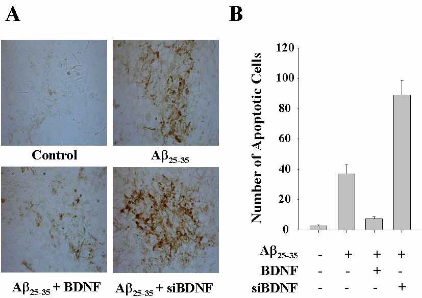 Fig. 3 Effects of up-regulation or down-regulation of BDNF on the Aβ25-35-induced apoptotic cell death